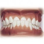 Orthodontics braces in bentleigh east